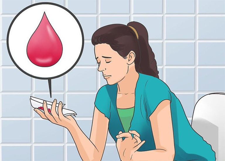 Thuốc Progesterone không sử dụng cho các trường hợp chạy máu âm đạo bất thường