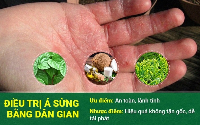 Chữa á sừng bằng phương pháp dân gian