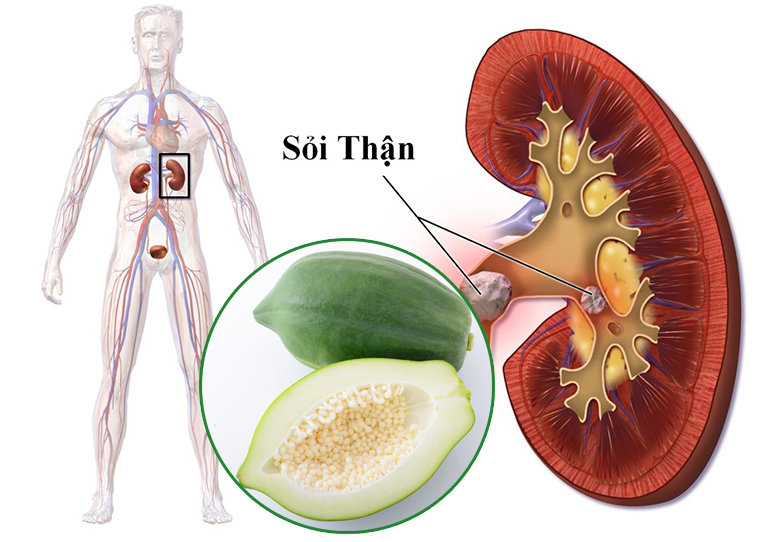 Cách chữa bệnh sỏi thận bằng đu đủ xanh