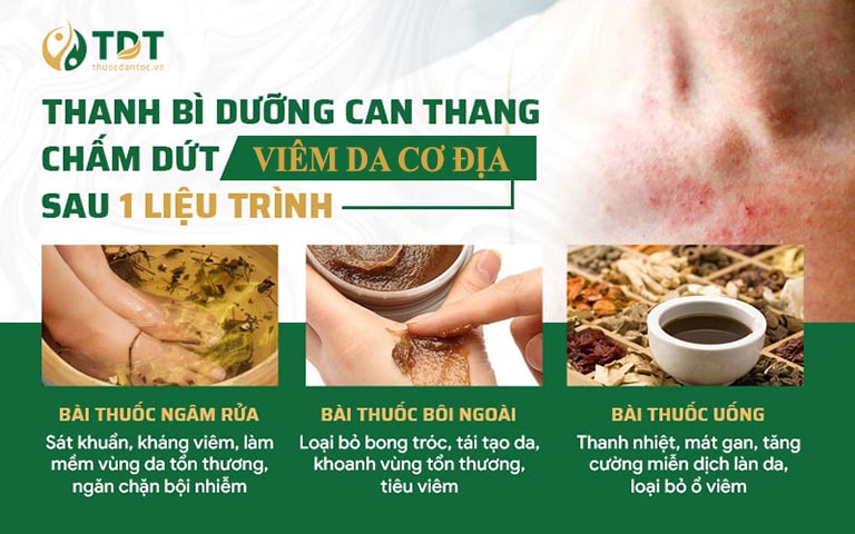 Bài thuốc mang công thức "3 trong 1" đặc biệt