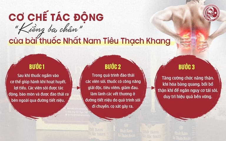 Cơ chế tác động "kiềng 3 chân" trong điều trị sỏi thận