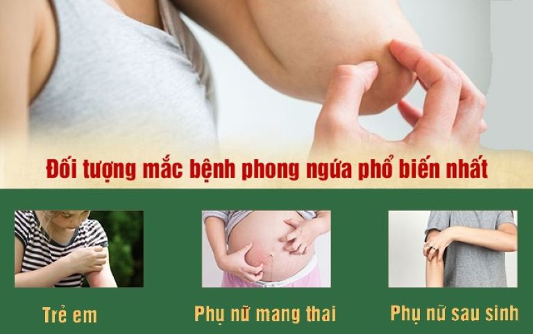 Đối tượng dễ mắc phong ngứa