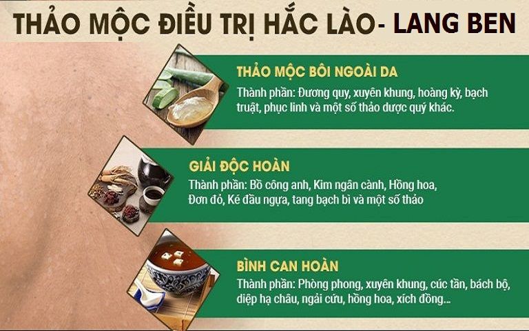 Thảo dược đặc trị hắc lào tận gốc, ngăn tái phát hiệu quả