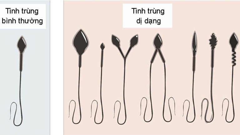 Hình dạng tinh trùng