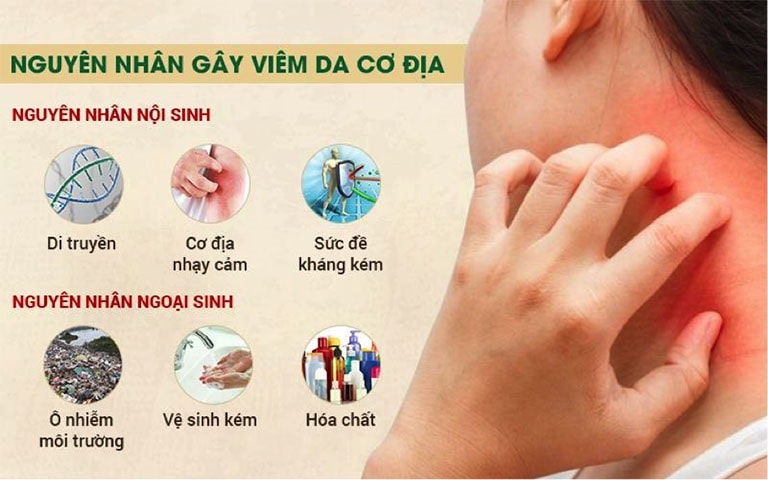 Nguyên nhân gây bệnh